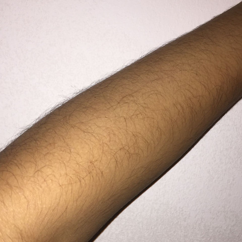 So sehen meine armhaare aus (die sind sehr sehr sichtbar) - (Mädchen, dunkel, Armhaare)