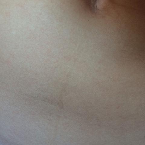 Dunkler Haut Strich Zum Bauchnabel Korper Arzt Bauch Dunkler Haut Strich Zum Bauchnabel Korper Arzt Bauch