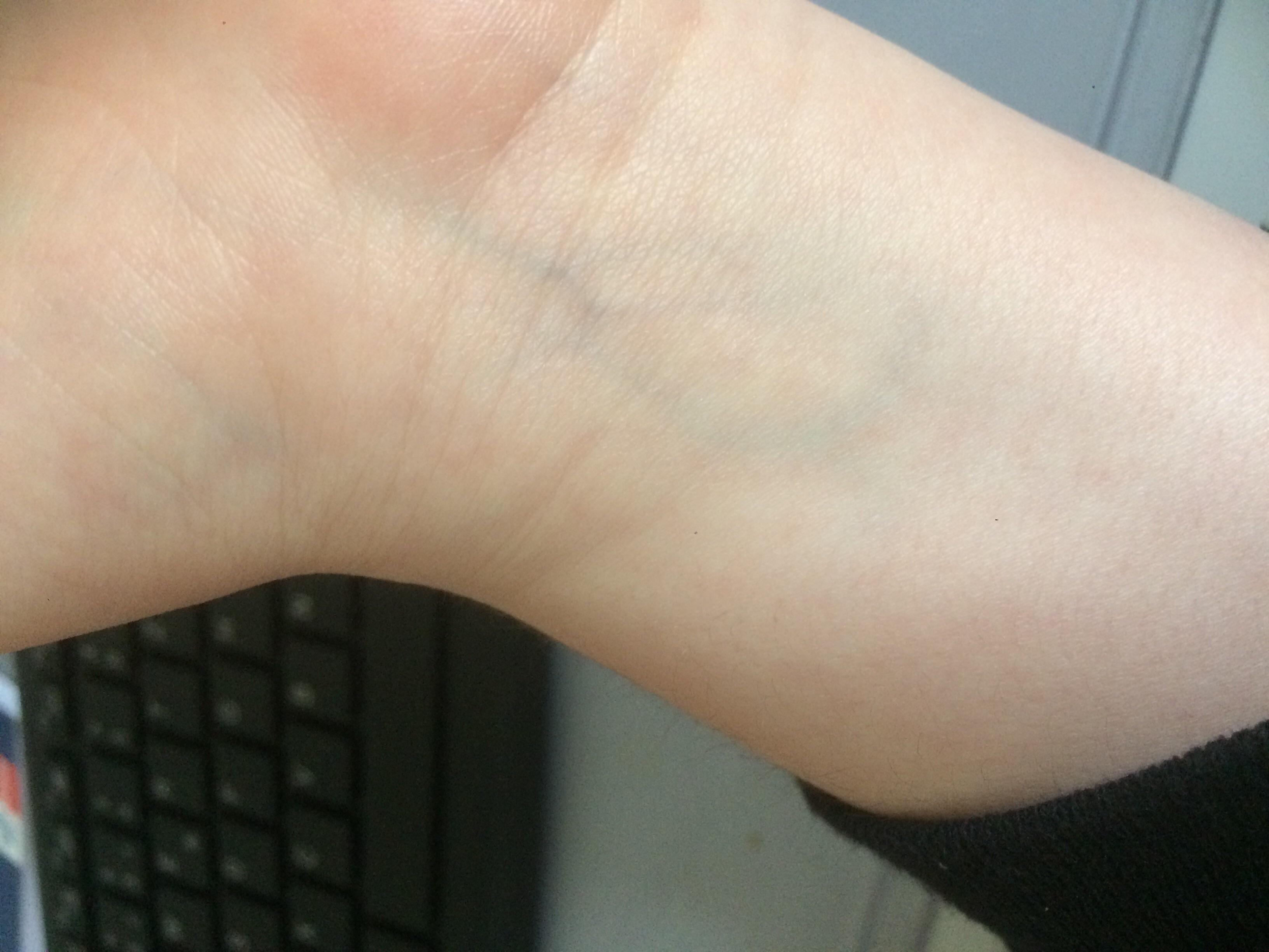 Durchblutungsstörungen in Ader an hand? (hypochonder)