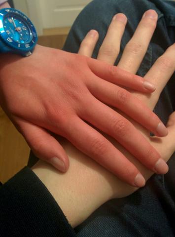 Meine Hand (die Obere) und die Hand meines Bruders (die Untere) - (Haut, Durchblutung)
