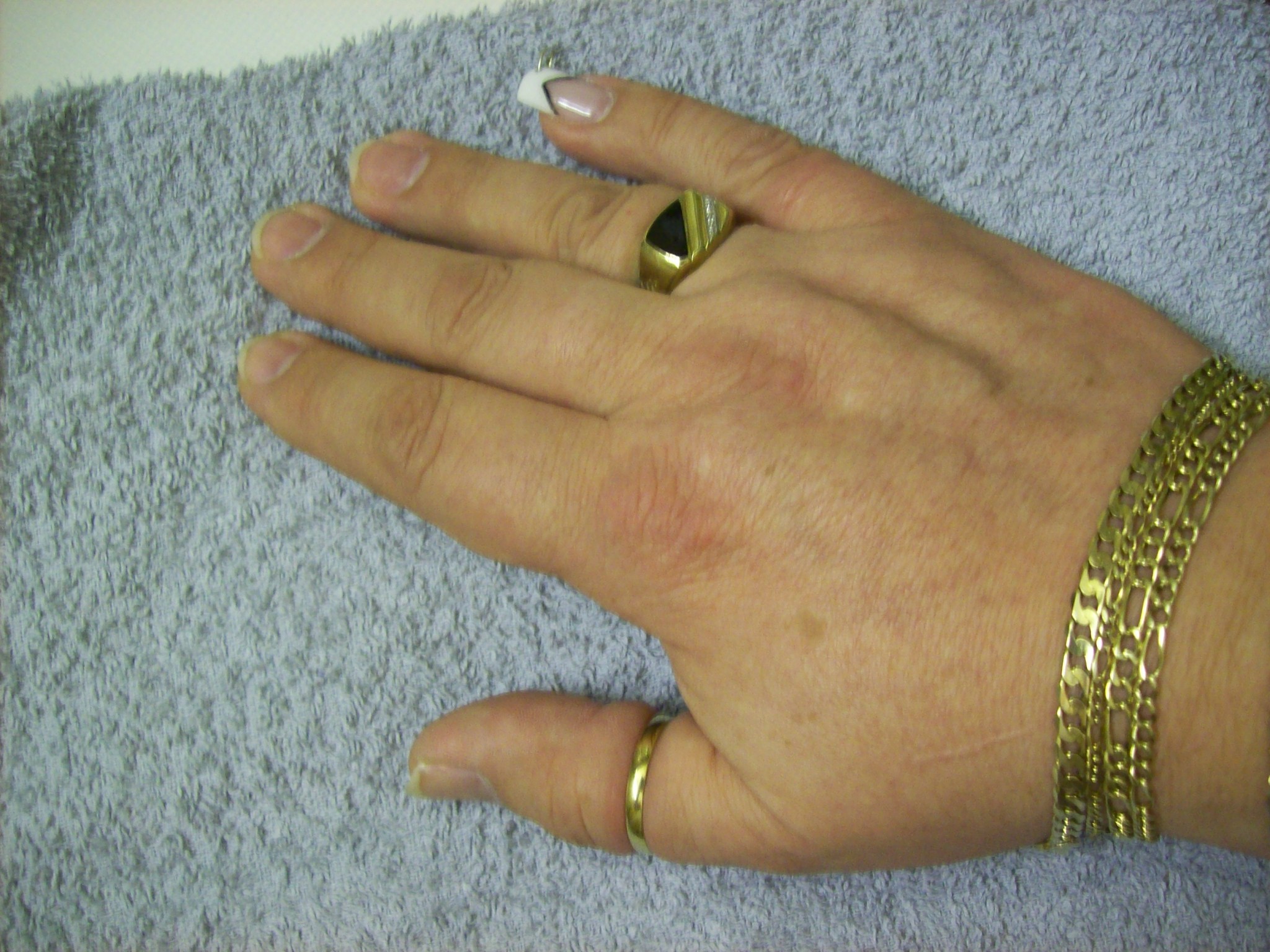 Ehering auch am Daumen, wenn am Ringfinger ein anderer Ring getragen wird? (Schmuck)