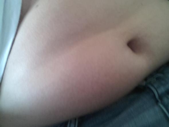 Eine Bekannte Sagt Ich Seie Fett Bin Auch Am Bauch Darum Ziehe Ich Den Bauch Immer Ein Ist Es Komisch Das Schmerzen Am Bauch Etwas Mag Anfassen Eine Bekannte Sagt Ich Seie Fett Bin Auch Am Bauch Darum Ziehe Ich Den Bauch Immer Ein Ist Es Komisch Das Schmerzen Am Bauch Etwas Mag Anfassen