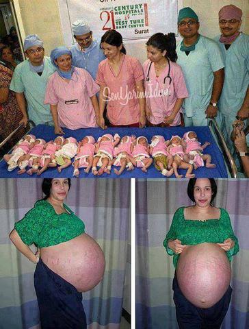 Die Frau mit gen Babys - (Schwangerschaft, Baby, Geburt)