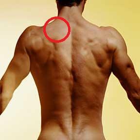 Eine Kleine Beule Im Oberen Ruckenbereich Sport Schmerzen Training Eine Kleine Beule Im Oberen Ruckenbereich Sport Schmerzen Training