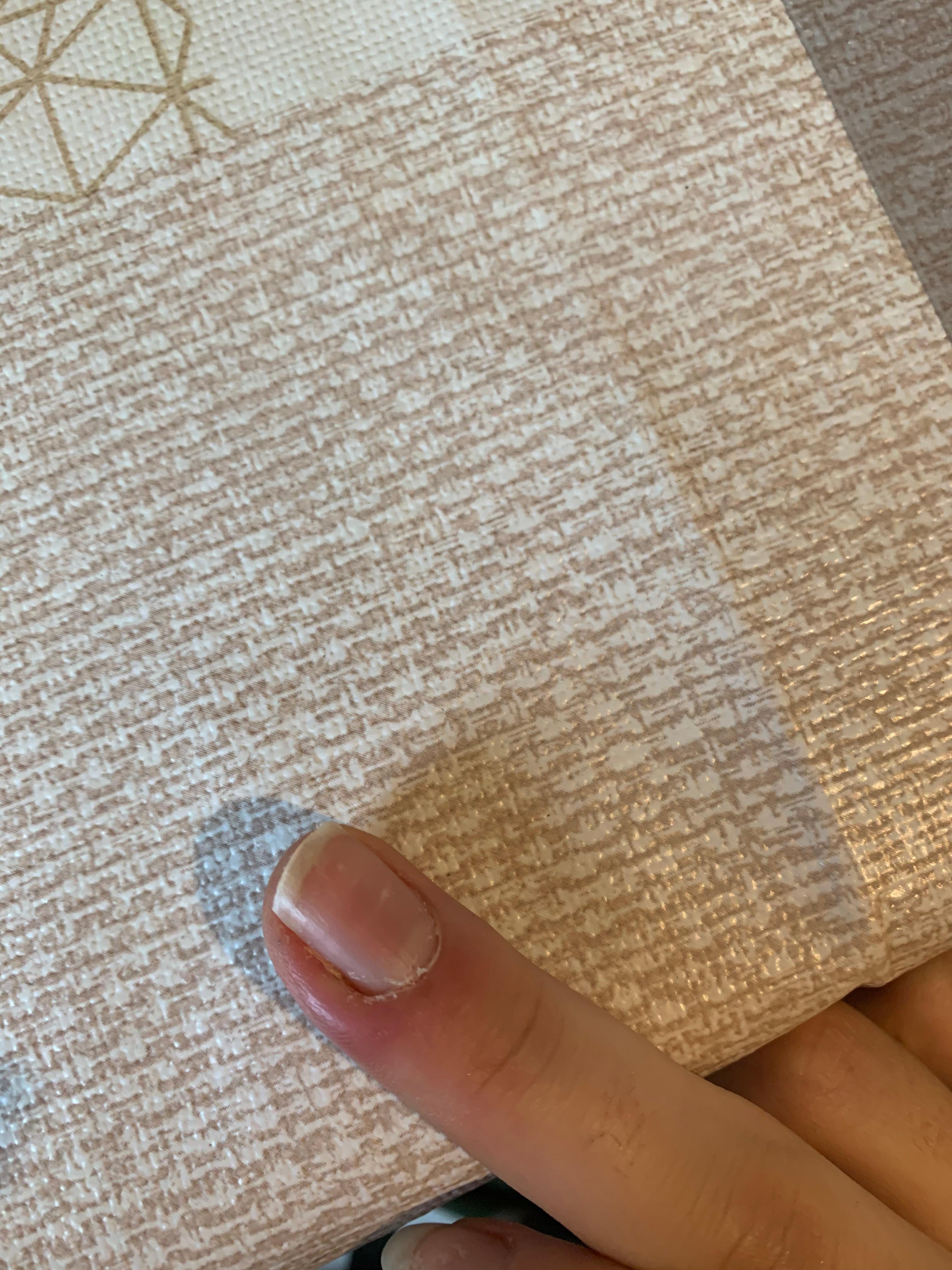 Eiter am Finger? (Gesundheit und Medizin, Gesundheit)