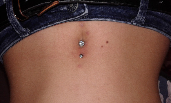 eiter breitet sich nach innen aus gesundheit pickel piercing