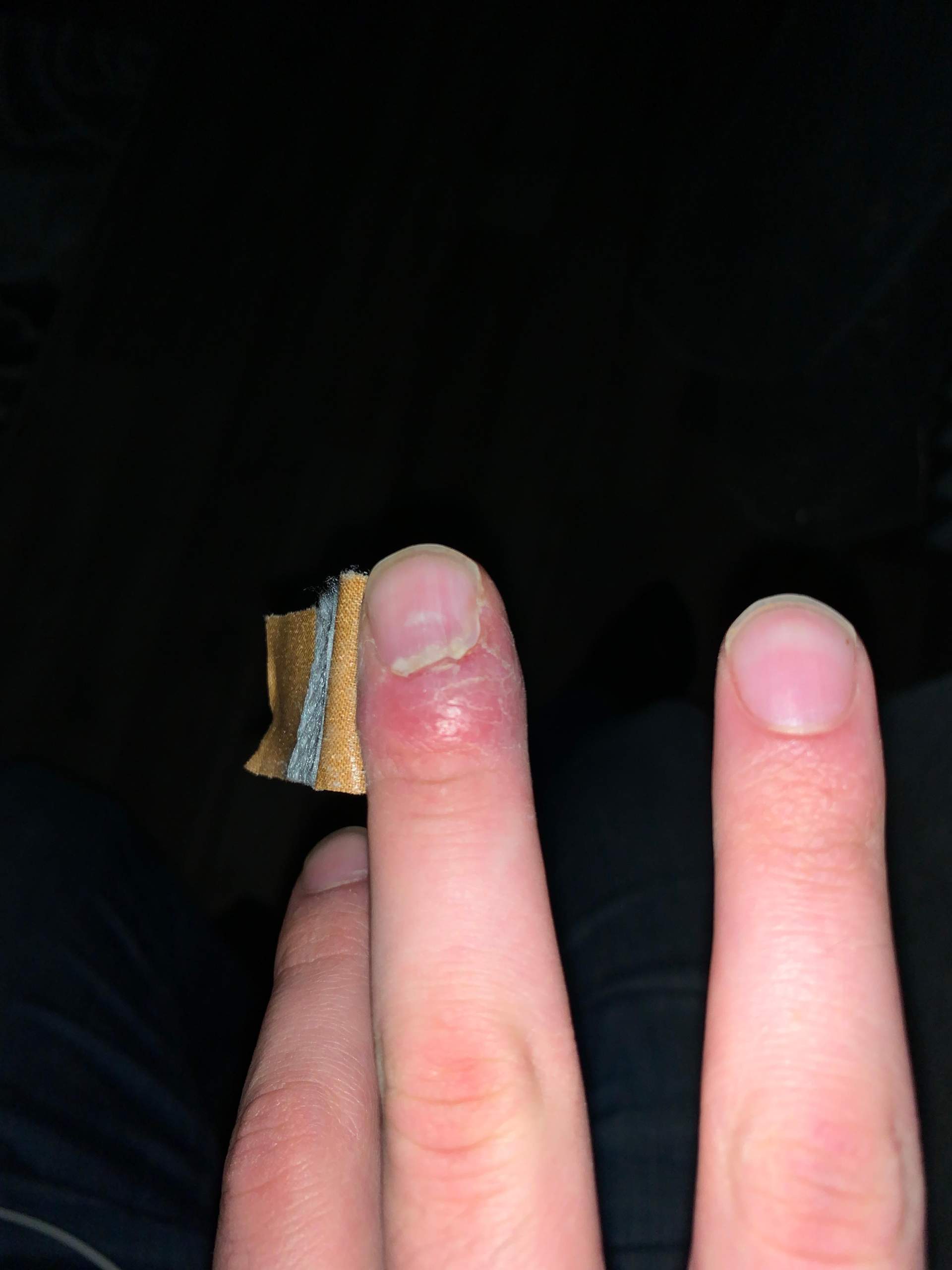 Splitter Im Finger Eiter - Quotes Trendy