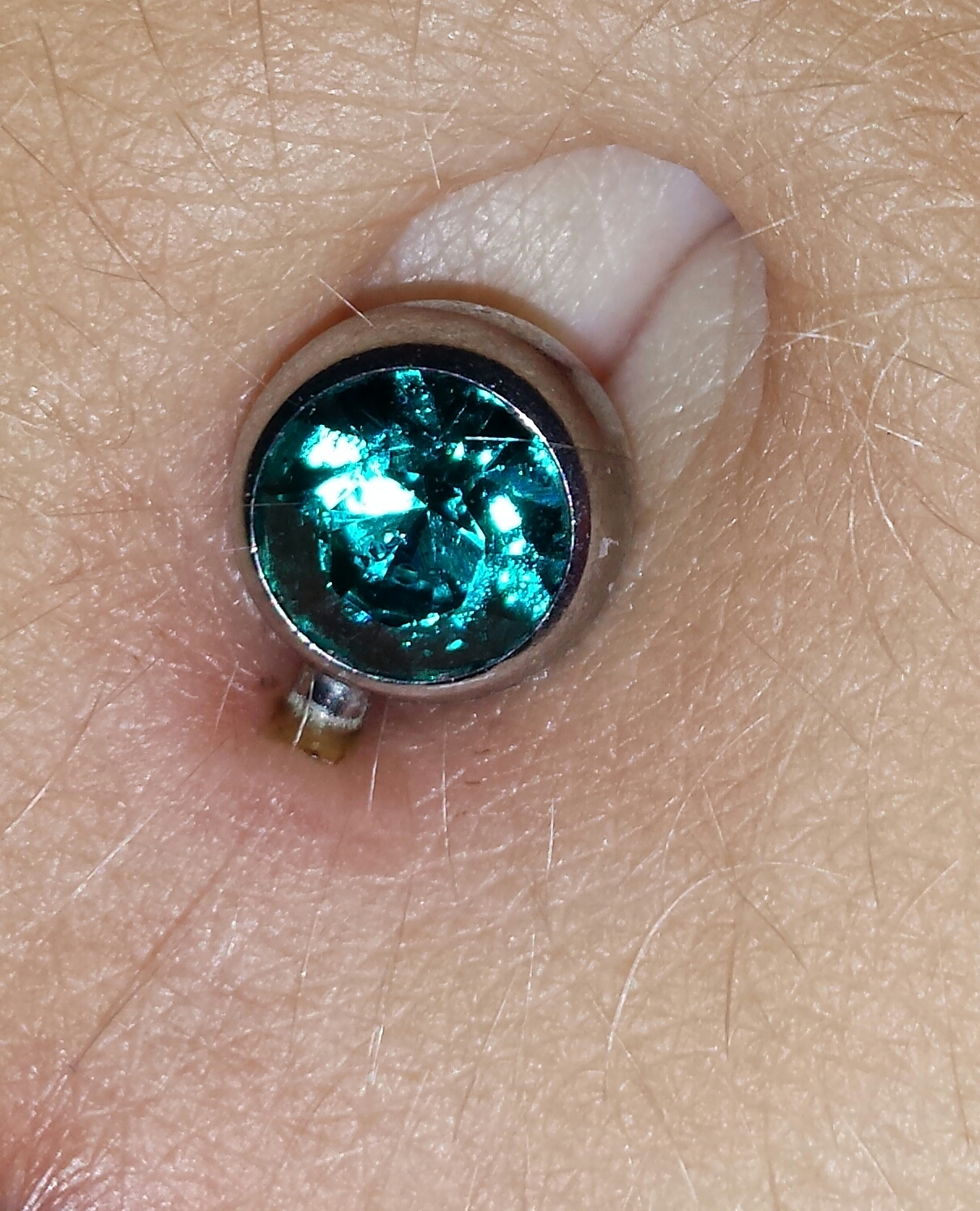Bauchnabelpiercing Eitert Aber Tut Nicht Weh eiter/sekret am bauchnabelpiercing (Piercing, Bauchnabel, Wundheilung)