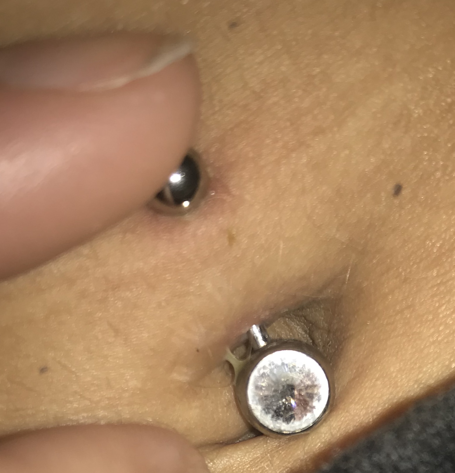 Eitert Es Oder Wundwasser Gesundheit Und Medizin Piercing Bauchnabelpiercing Eitert Es Oder Wundwasser Gesundheit Und Medizin Piercing Bauchnabelpiercing
