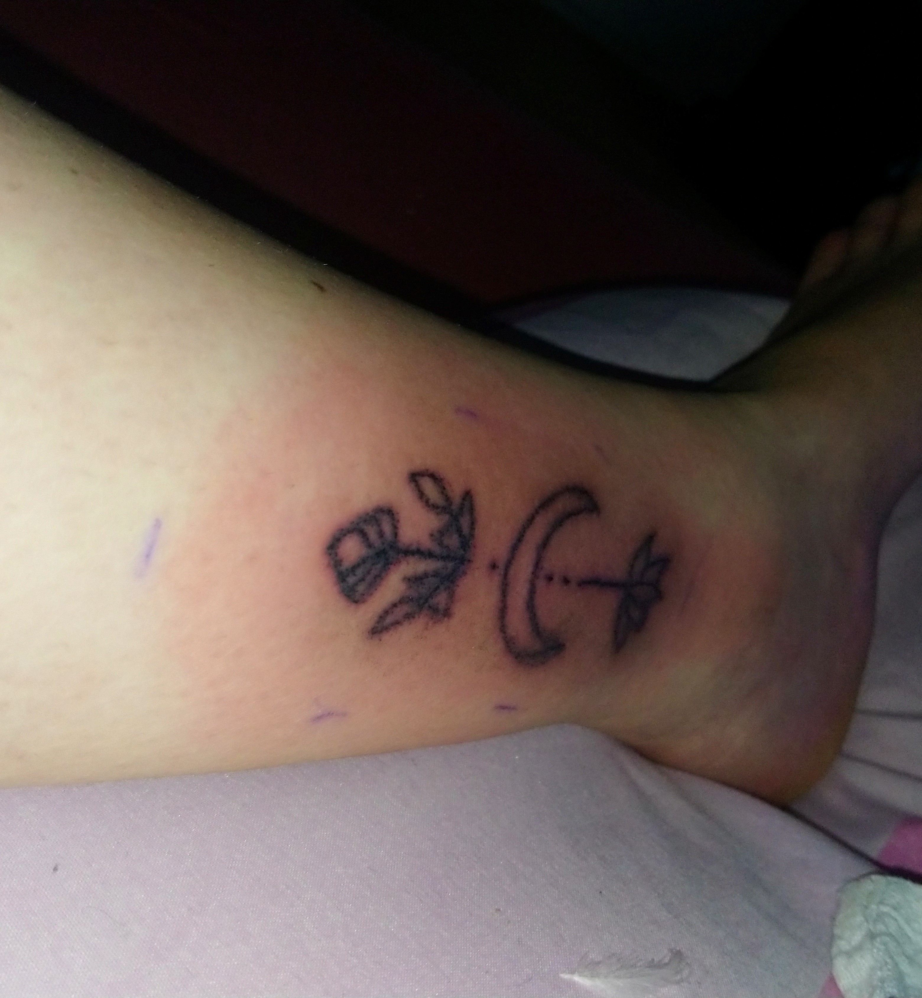 Entwickelt sich da eine Blutvergiftung? (Tattoo)