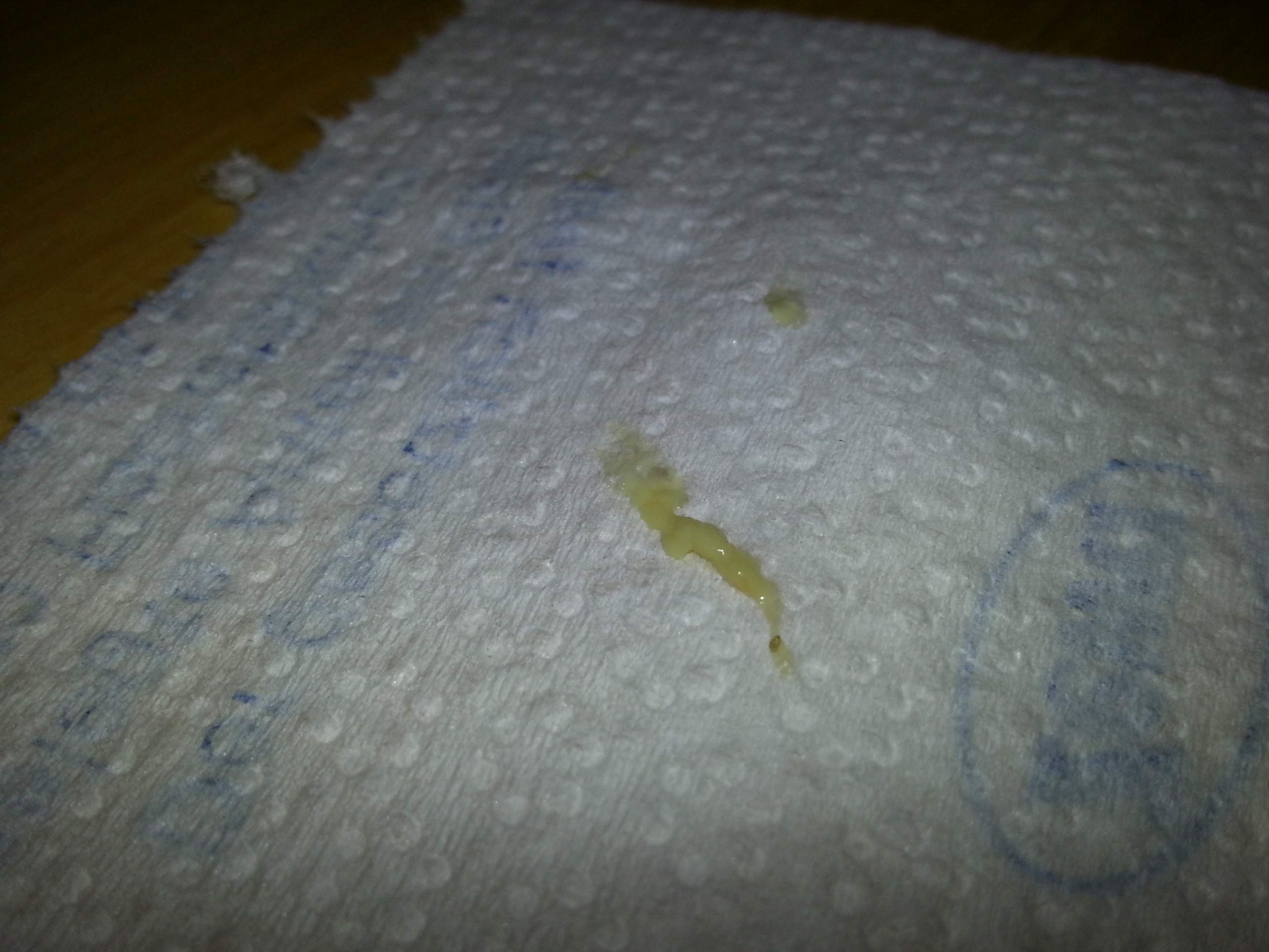 entzündeter finger (eiter unterm nagel) (Schmerzen, Entzündung)