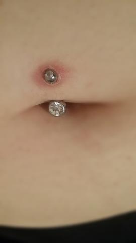 entzundetes bauchnabelpiercing normal piercing entzundet