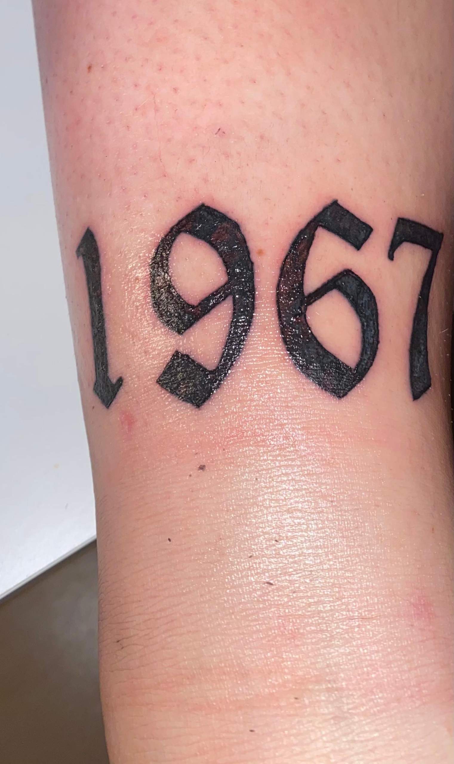 Entzündetes Tattoo? (Entzündung)