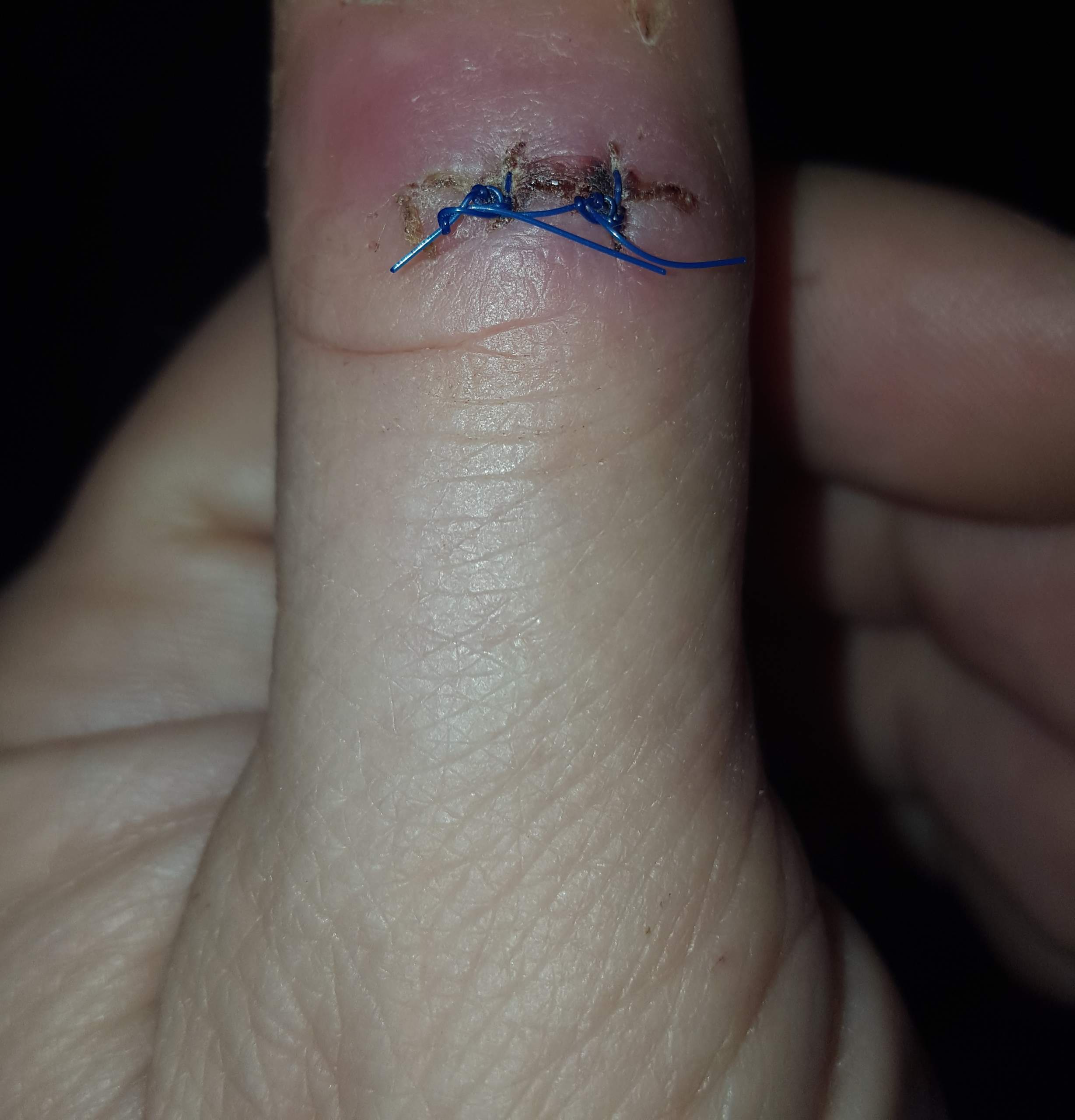 Eg0sxtldharfam Eg0sxtldharfam