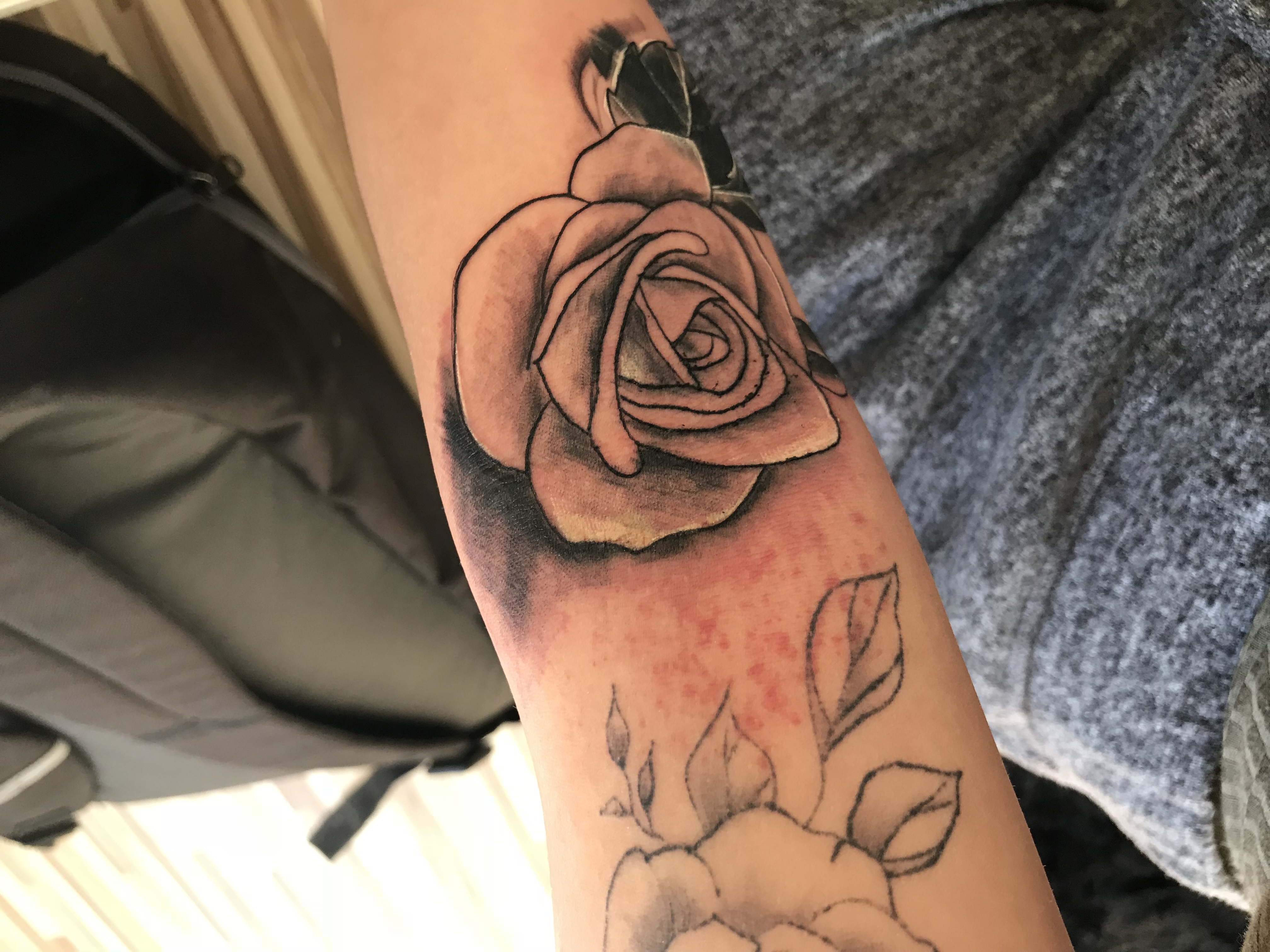 Entzündung am Tattoo? (blutergüsse)