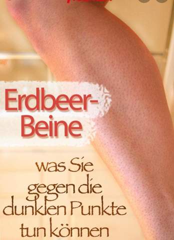 Erdbeerbeine Und Rasierpickel Gesundheit Und Medizin Ernahrung Beauty