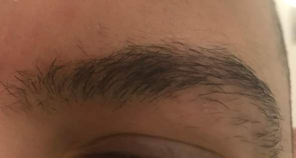 Es Geht Einfach Nicht Weg Wie Kann Ich Diese Weissen Runden Schuppen Auf Meinen Augenbrauen Loswerden Gesundheit Und Medizin Haare Beauty