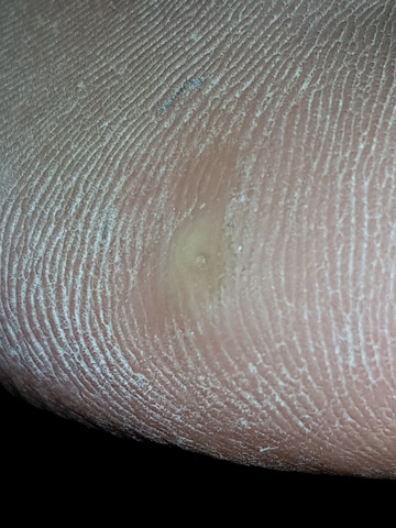- (Gesundheit und Medizin, Füße, Fußpflege)
