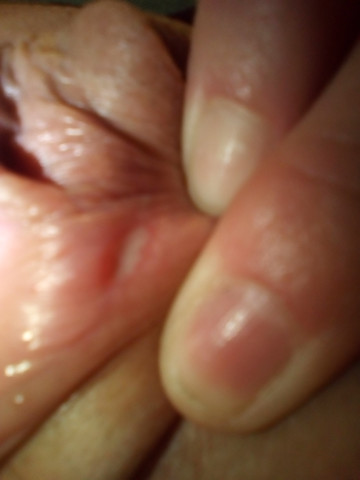 Es Tut Sehr Weh Was Ist Das Vagina Brennen Es Tut Sehr Weh Was Ist Das Vagina Brennen