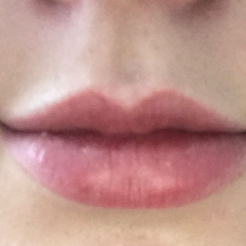 So sehen meine Lippen nochmal auf einem Bild aus 😂 - (Piercing, ashley piercing, Eskimo Piercing)