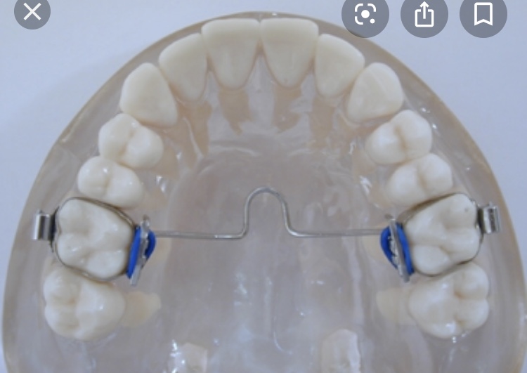 Essen Mit Zahnspange Und Gaumenbugel Zahne Zahnarzt Kieferorthopadie