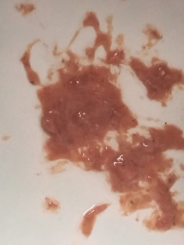 Essen Oder Blut Erbrochen Essen Oder Blut Erbrochen