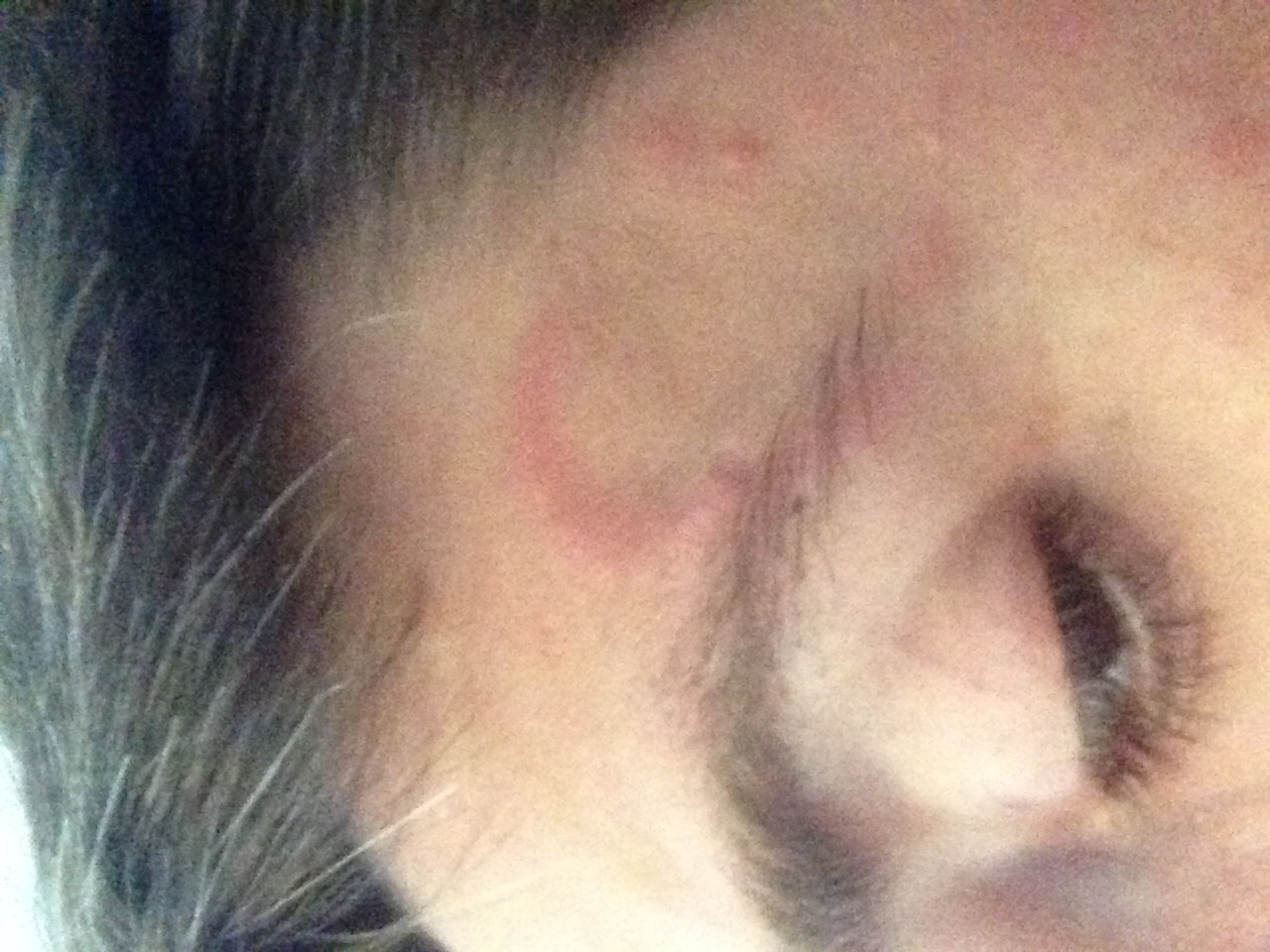 Etwas geschwollener roter Strich seit 7