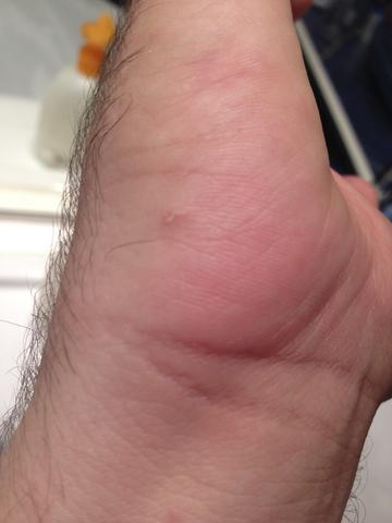 Kratze Die Meistgelesenen Fragen Kratze Die Meistgelesenen Fragen