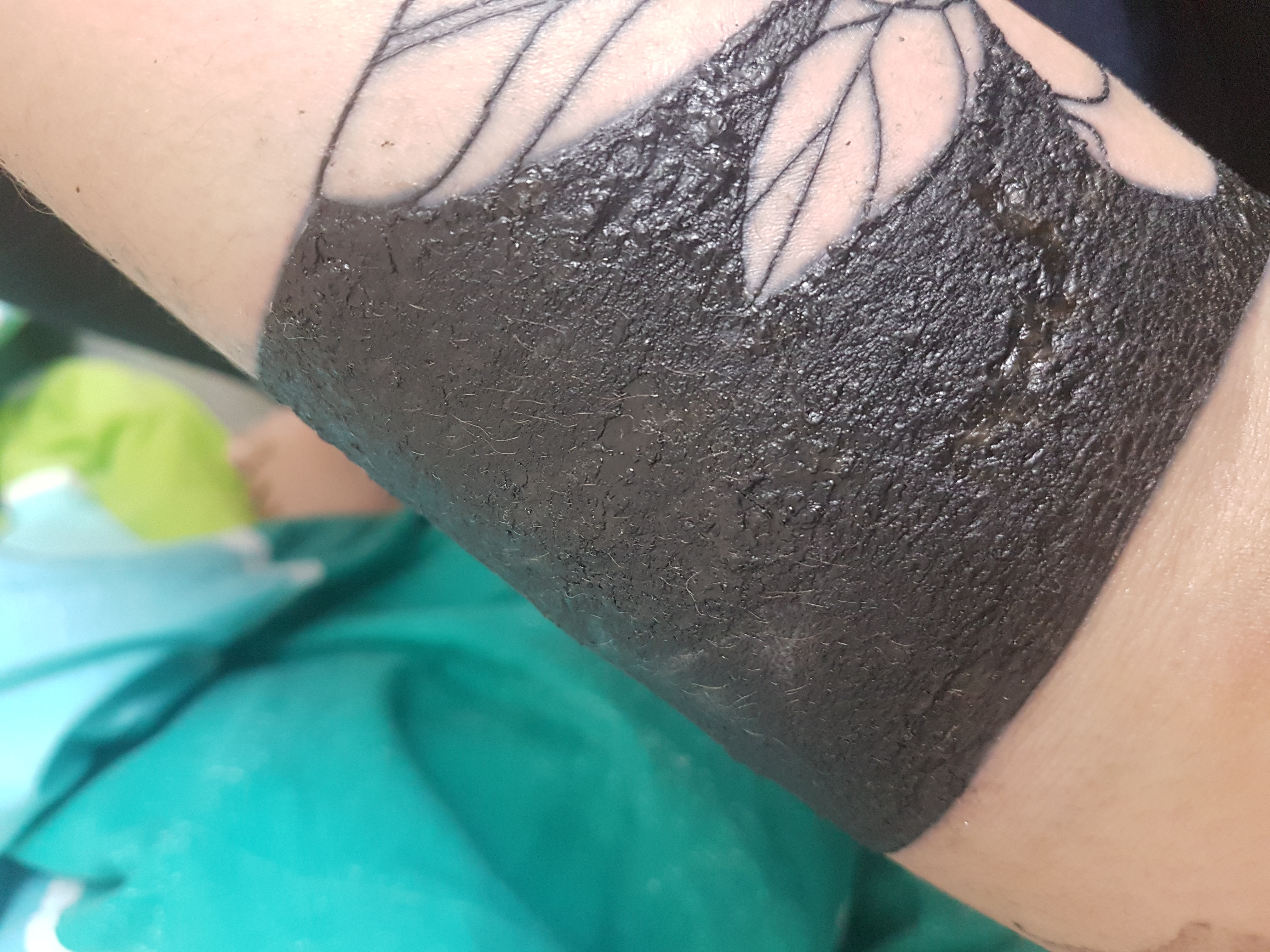 evtl Entzündet? (Gesundheit und Medizin, Arzt, Tattoo)