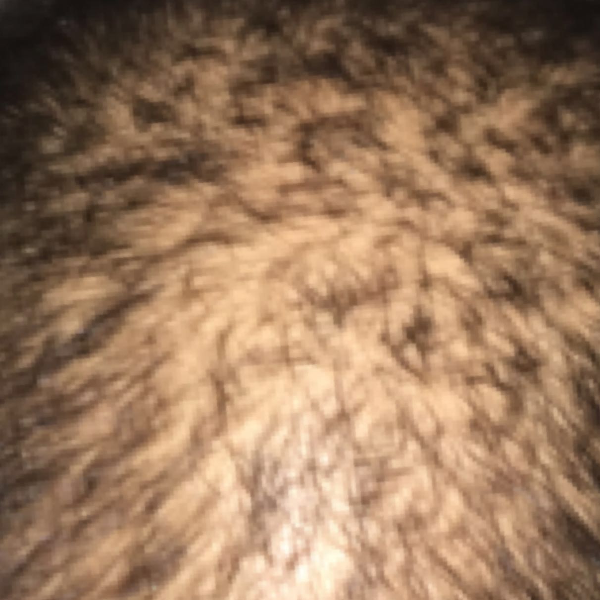 extrem dunne haare gleich haarausfall