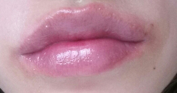 Lippen Extrem Trocken