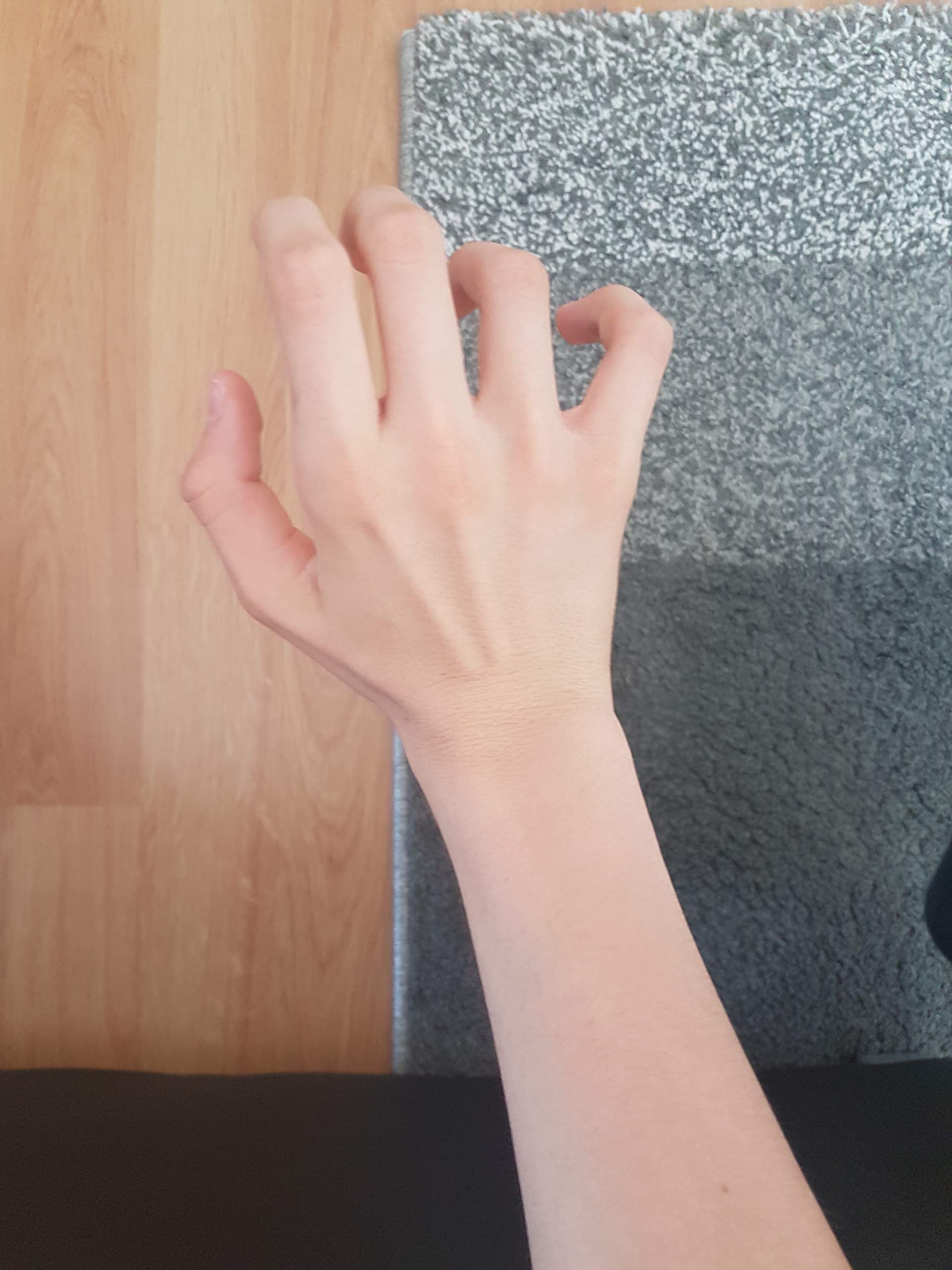 Extrem(wirkl extrem) dünnes Handgelenk? (Gesundheit und Medizin, Körper ...