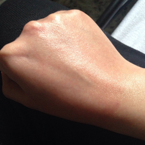 Allergische Reaktion meine Hand  - (Allergie, Hand)