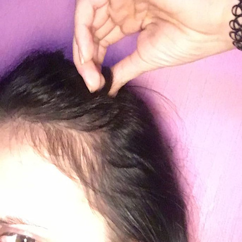 Fallen Bald Meine Ganzen Haare Aus Gesundheit Tipps Haarausfall Fallen Bald Meine Ganzen Haare Aus Gesundheit Tipps Haarausfall