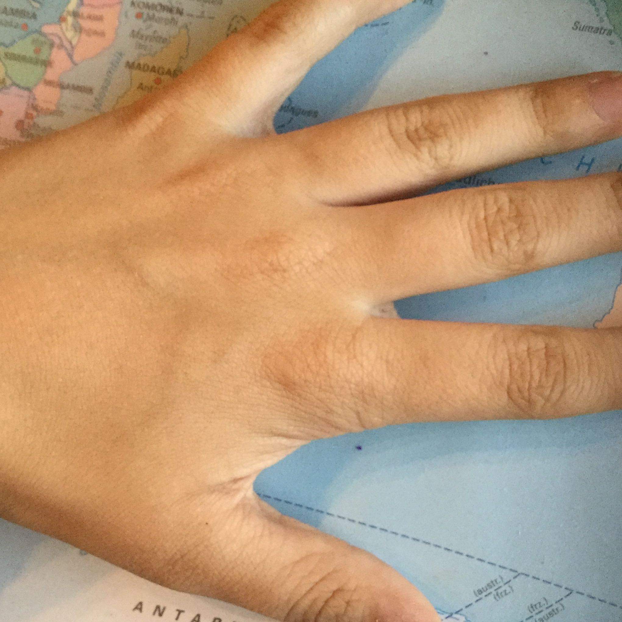Faltige Hände mit 12? (Kosmetik, Hand, Falten)