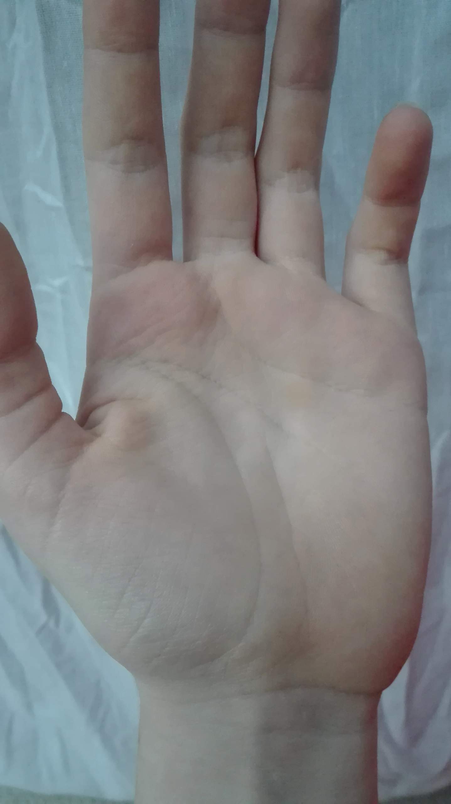 Faltige Hände mit 13? (Gesundheit und Medizin, Falten, Alterung)