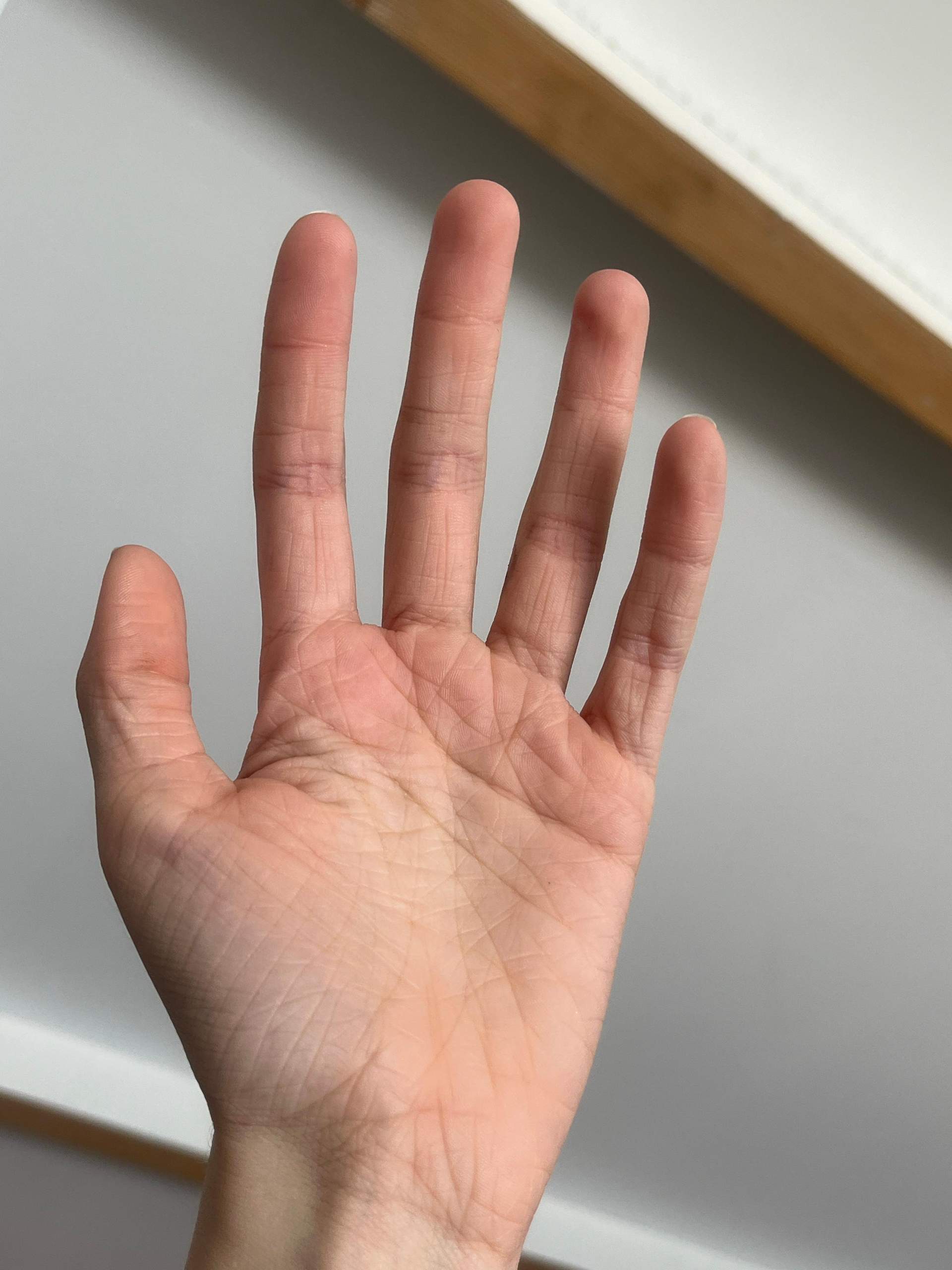 faltige hände mit 15? (Körper, Haut, Pflege)