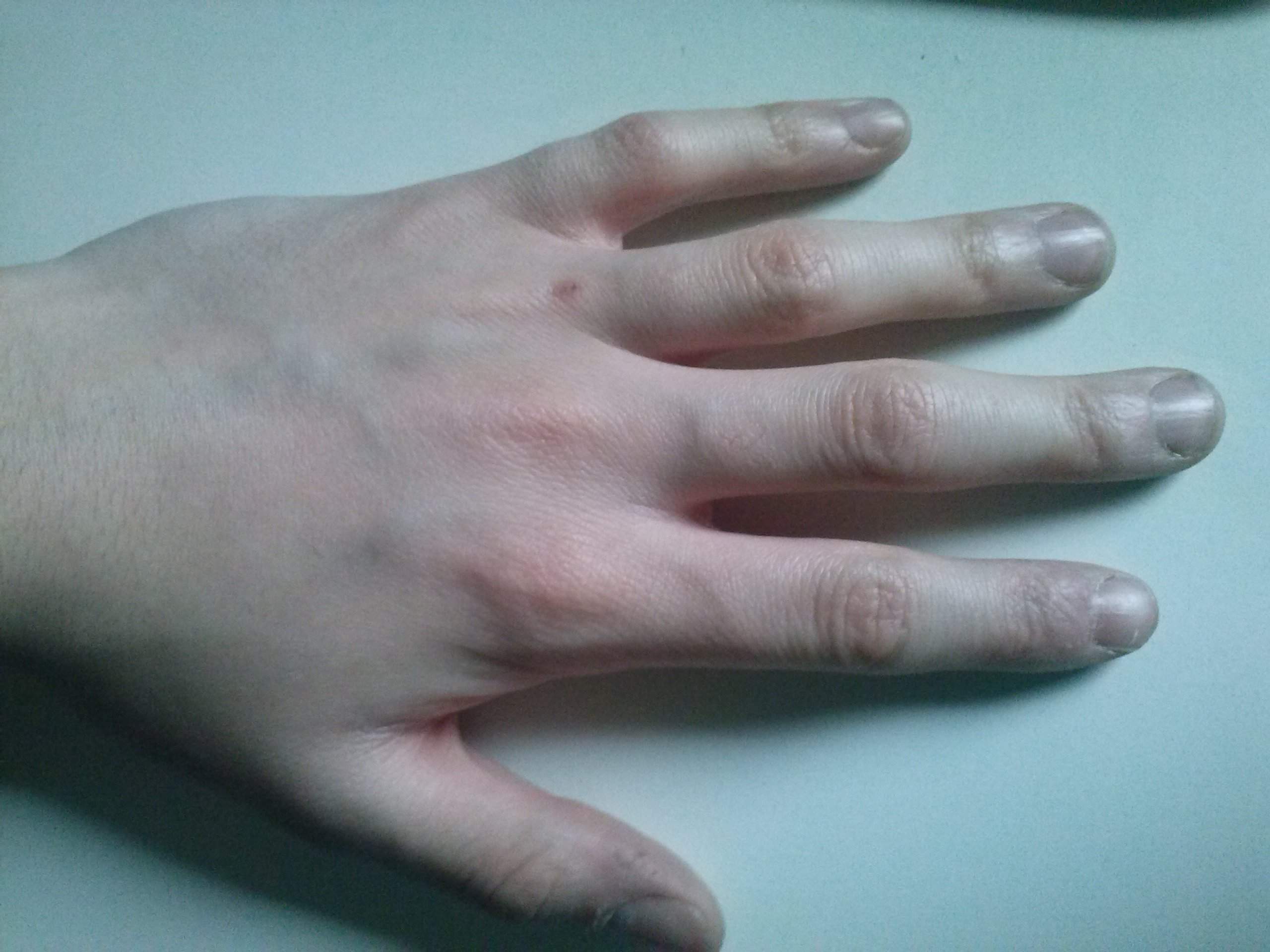 faltige und häslige hände und finger (Hand)