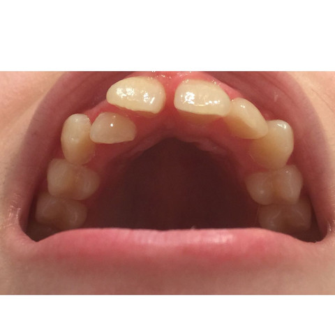 Zähne  - (Gesundheit, Zähne, Zahnspange)
