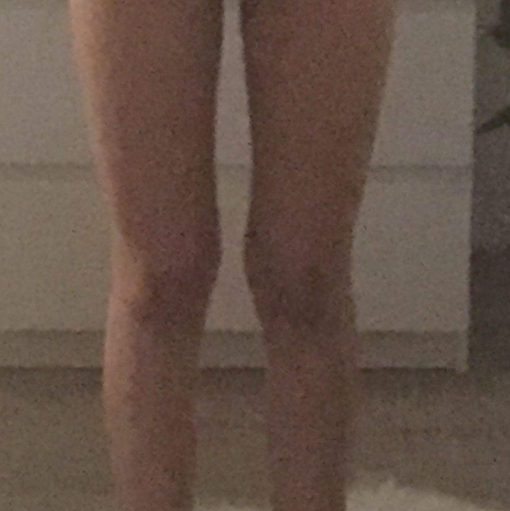 Fett An Der Knie Innenseite Gesundheit Und Medizin Ernahrung Sport Und Fitness Fett An Der Knie Innenseite Gesundheit Und Medizin Ernahrung Sport Und Fitness
