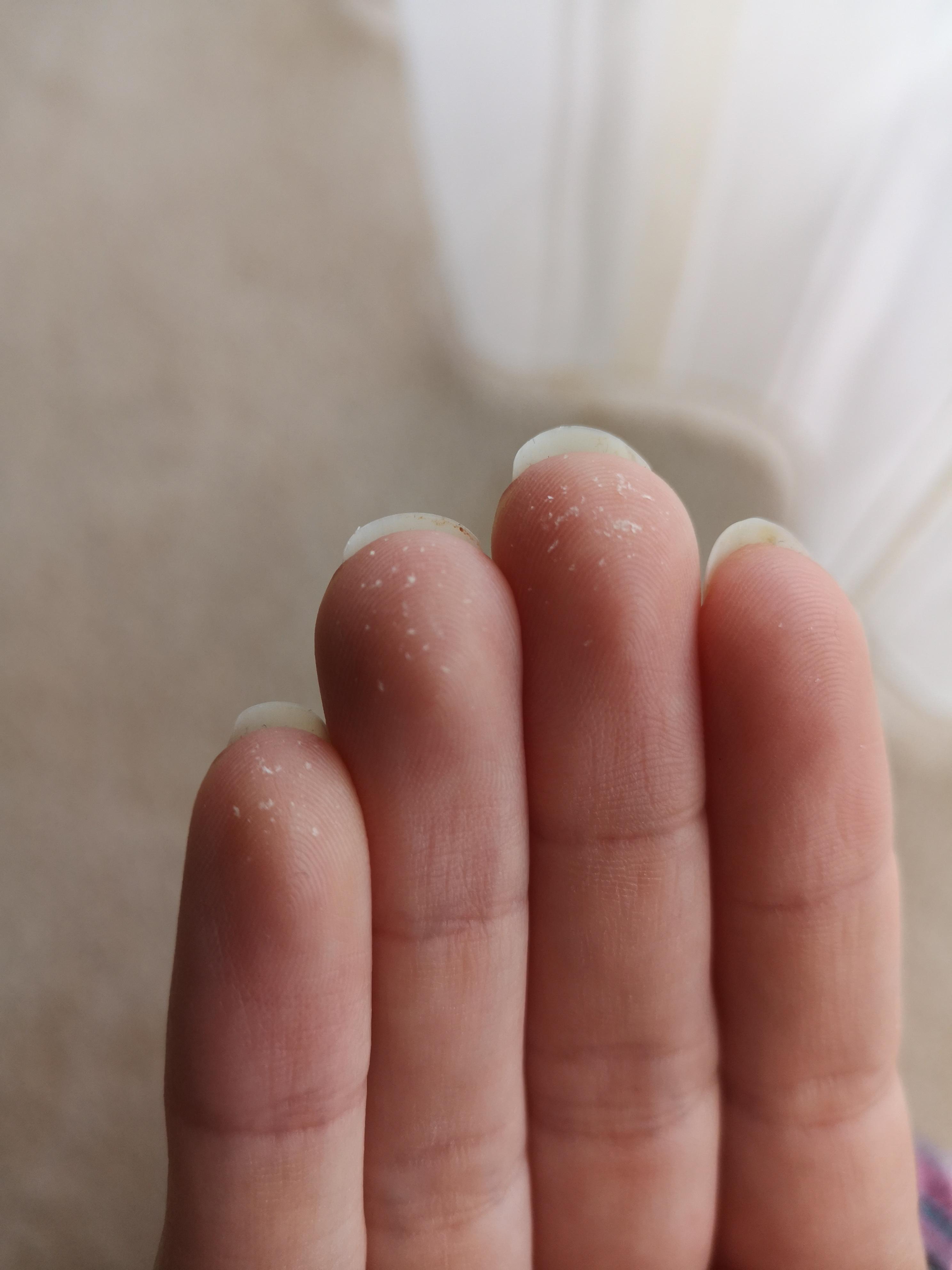 juckende kopfhaut kennt ihr euch