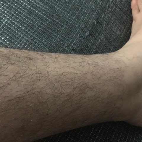 jahre alt haare manner beine