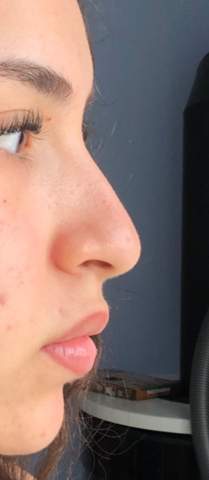 Findet Ihr Die Nase Zu Gross Und Schlimm Hasslich Unsicher Kein Selbstbewusstsein