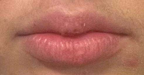 Findet ihr diese Lippen schön?