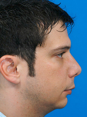 Findet Ihr Frauen So Eine Gesichtsform Hasslich Aussehen Gesicht