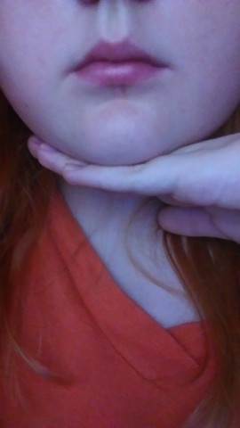 Findet Ihr Ich Sollte Mein Kinn Operieren Schonheits Op