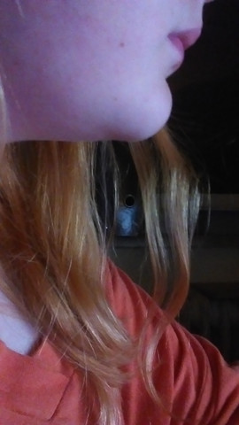 Findet Ihr Ich Sollte Mein Kinn Operieren Schonheits Op