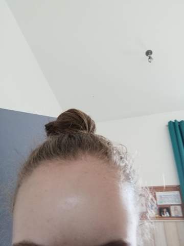 Findet Ihr Ist Das Einen Hohe Stirn Ehrliche Meinung Aussehen Gesicht Haaransatz