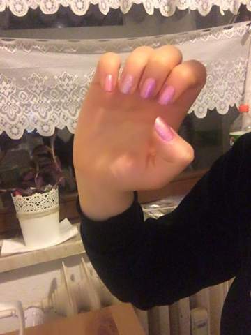 Findet Ihr Meine Nagel Sehr Kurz Tipps Meinung Fragen