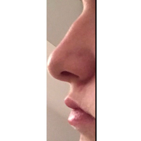 Findet Ihr So Eine Nase Hasslich Bei Einem R Madchen Frau Und Findet Ihr Das Der Buckel Sehr Gross Ist Bzw Die Nase Hocker Findet Ihr So Eine Nase Hasslich Bei Einem R Madchen Frau Und Findet Ihr Das Der Buckel Sehr Gross Ist Bzw Die Nase Hocker